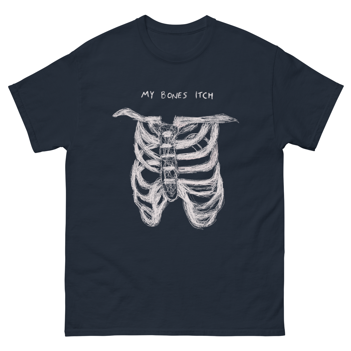My Bones Itch Tee